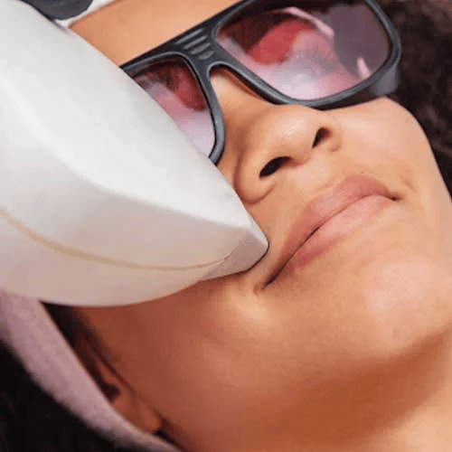 Laser Treatment